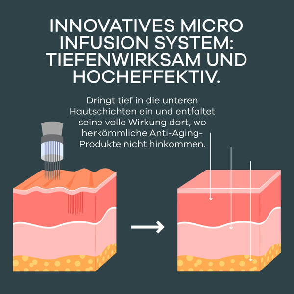 Seluné Micro Infusion System™