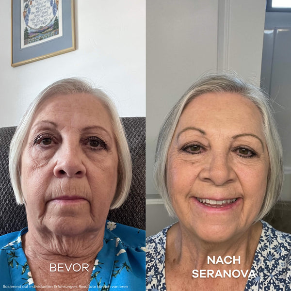 Seluné Micro Infusion System™